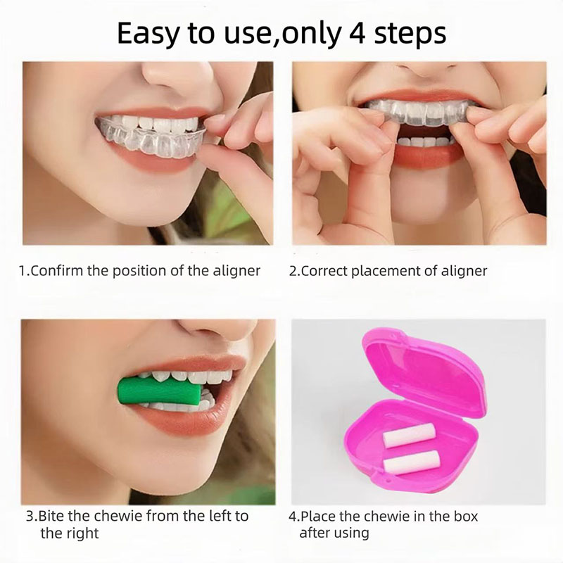 5 คู่/ชุด อุปกรณ์จัดฟันแบบเคี้ - Alignment Stick Set บทวิจารณ์และราคา